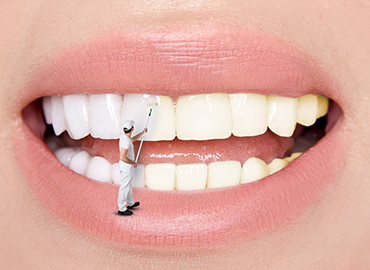 Zahnreinigung Zahnarzt Neumarkt